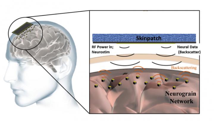 Eine Konzeptzeichnung eines Gehirns mit Mikrochips auf der Obefläche