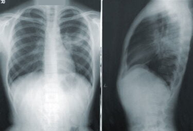 KI-Radiologen nehmen große Hürde für klinischen Einsatz