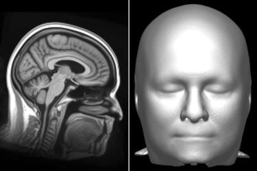 Studie: KI identifiziert Gesichter korrekt anhand eines Hirnscans