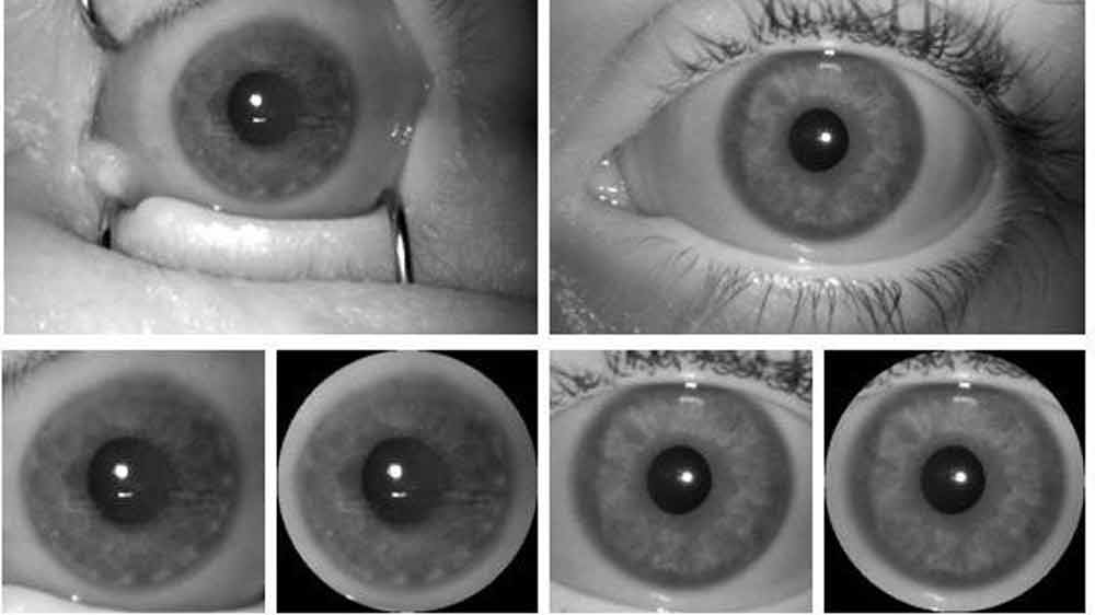 KI-Iris-Scanner kann tote von lebendigen Augen unterscheiden