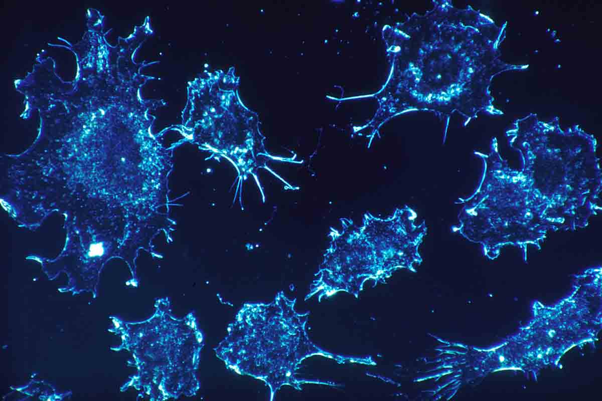 KI-Pathologe: Künstliche Intelligenz erkennt Lungenkrebs samt Genmutation