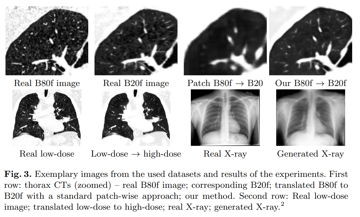 Beispiele für medizinische KI-Bilder im Vergleich zu Originalaufnahmen. Bild: Universität Lübeck