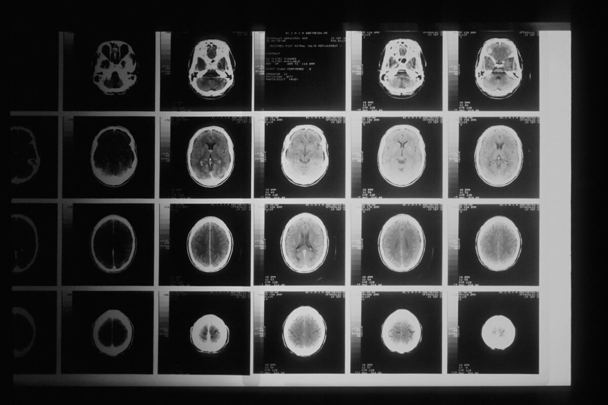Eine medizinische Aufnahme mit Bildern eines Gehirns