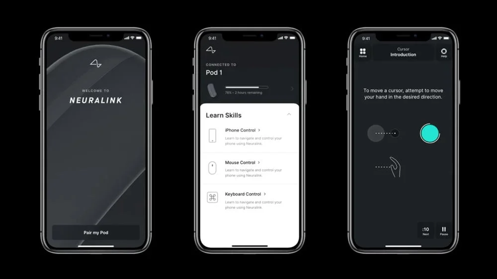 Die Smartphone-App bietet Trainingsprogramme, mit denen man lernt, seine Hirnsignale gezielt einzusetzen. Bild: Neuralink