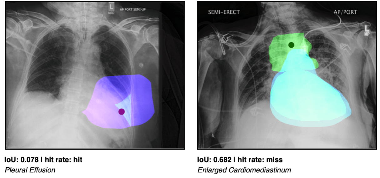 KI-Diagnostik: Verbreitete Methode schneidet in Benchmark schlecht ab