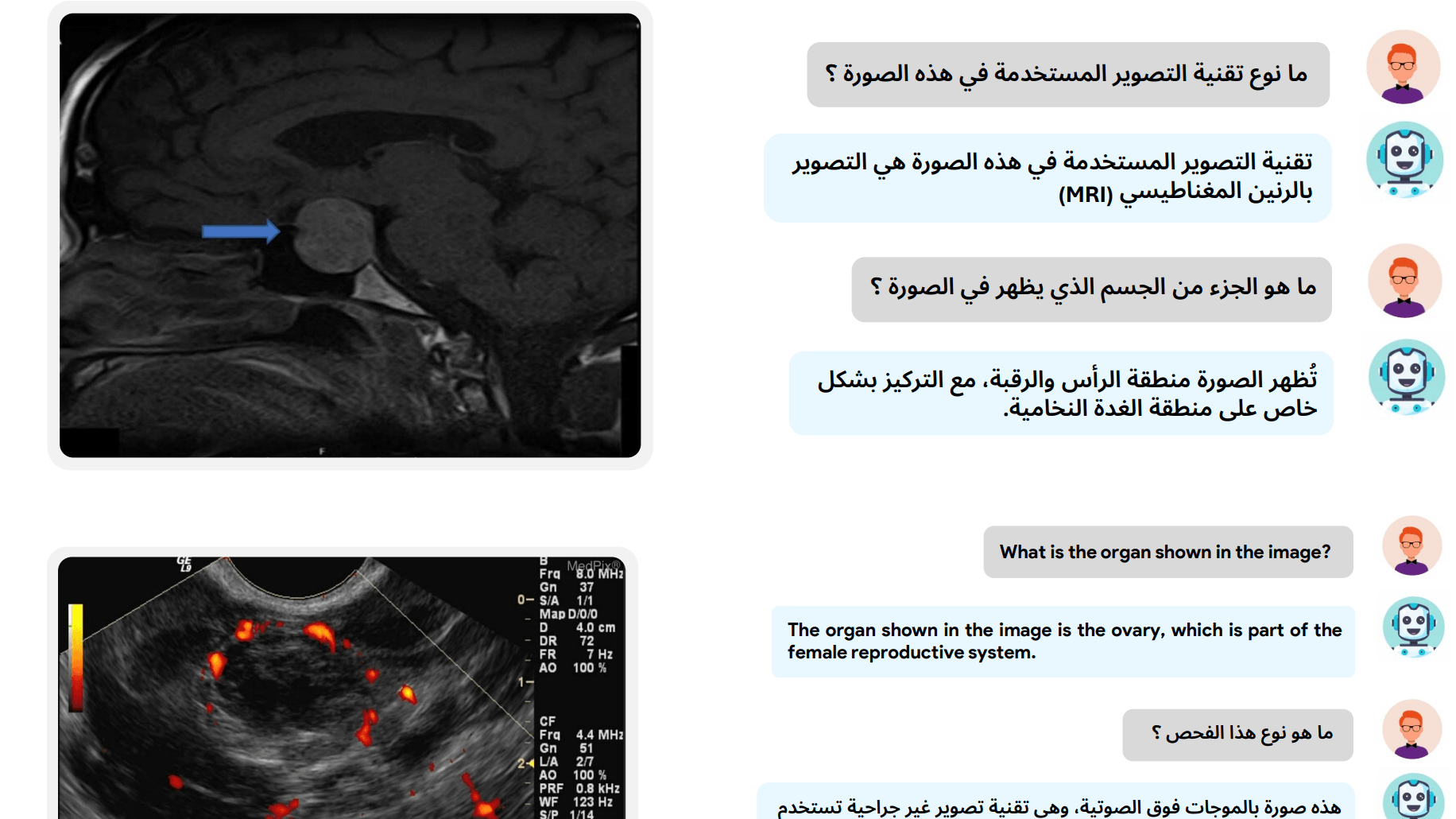 BiMediX2: Leistungsstarke KI für medizinische Bildanalyse auf Englisch und Arabisch