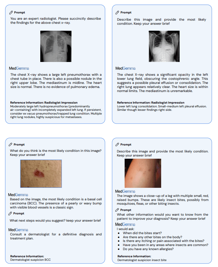 Collage: Thoraxröntgen mit linksseitigem Pneumothorax m. Drainage und Konsolidation; perlmuttfarbene Papula; rote Papeln.