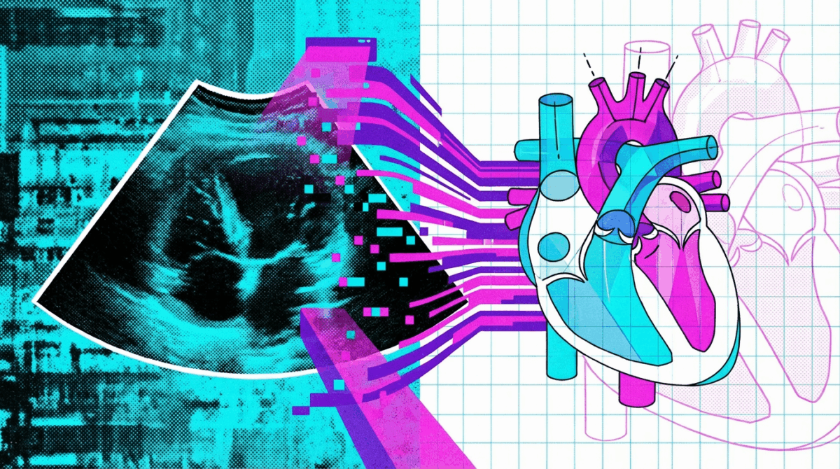 Forscher testen alternatives KI-Verfahren von Meta an 18 Millionen Herzultraschallvideos
